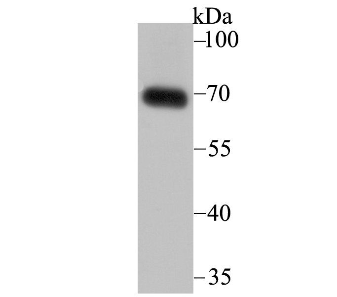Western blot analysis of SNX1 on human skin tissue lysates. Proteins were transferred to a PVDF membrane and blocked with 5% BSA in PBS for 1 hour at room temperature. The primary antibody (ET7109-02, 1/500) was used in 5% BSA at room temperature for 2 hours. Goat Anti-Rabbit IgG - HRP Secondary Antibody (HA1001) at 1:200,000 dilution was used for 1 hour at room temperature.