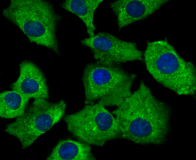 ICC staining of SNX1 in A549 cells (green). Formalin fixed cells were permeabilized with 0.1% Triton X-100 in TBS for 10 minutes at room temperature and blocked with 10% negative goat serum for 15 minutes at room temperature. Cells were probed with the primary antibody (ET7109-02, 1/50) for 1 hour at room temperature, washed with PBS. Alexa Fluor®488 conjugate-Goat anti-Rabbit IgG was used as the secondary antibody at 1/1,000 dilution. The nuclear counter stain is DAPI (blue).