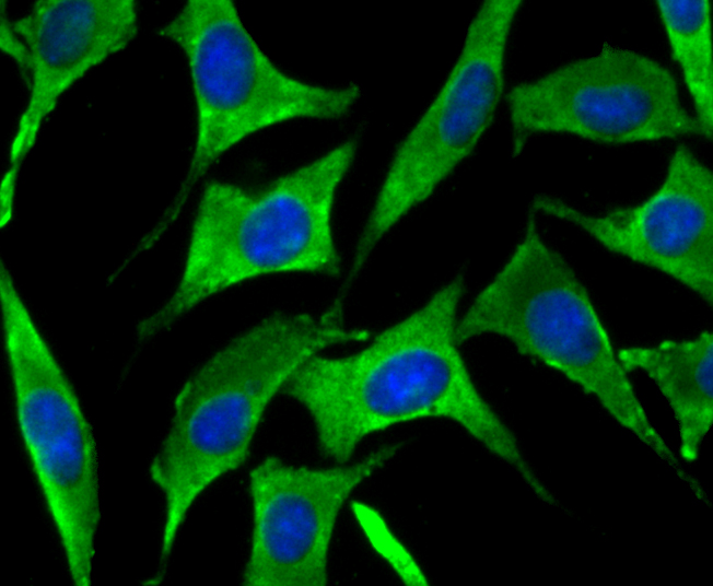 ICC staining of SNX1 in SH-SY5Y cells (green). Formalin fixed cells were permeabilized with 0.1% Triton X-100 in TBS for 10 minutes at room temperature and blocked with 10% negative goat serum for 15 minutes at room temperature. Cells were probed with the primary antibody (ET7109-02, 1/50) for 1 hour at room temperature, washed with PBS. Alexa Fluor®488 conjugate-Goat anti-Rabbit IgG was used as the secondary antibody at 1/1,000 dilution. The nuclear counter stain is DAPI (blue).