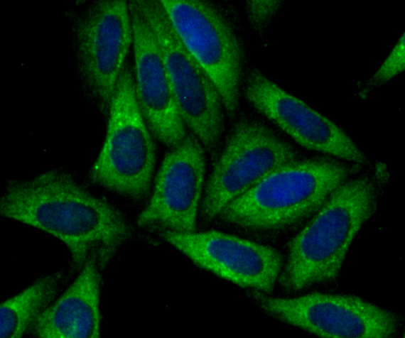 ICC staining of SNX1 in SiHa cells (green). Formalin fixed cells were permeabilized with 0.1% Triton X-100 in TBS for 10 minutes at room temperature and blocked with 10% negative goat serum for 15 minutes at room temperature. Cells were probed with the primary antibody (ET7109-02, 1/50) for 1 hour at room temperature, washed with PBS. Alexa Fluor®488 conjugate-Goat anti-Rabbit IgG was used as the secondary antibody at 1/1,000 dilution. The nuclear counter stain is DAPI (blue).