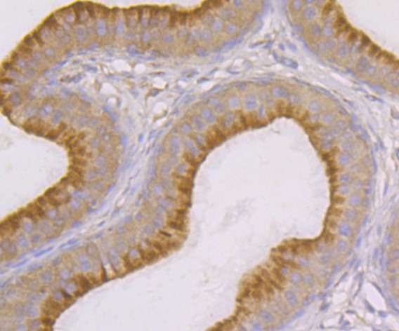 Immunohistochemical analysis of paraffin-embedded rat epididymis tissue using anti-SNX1 antibody. The section was pre-treated using heat mediated antigen retrieval with Tris-EDTA buffer (pH 9.0) for 20 minutes.The tissues were blocked in 1% BSA for 30 minutes at room temperature, washed with ddH2O and PBS, and then probed with the primary antibody (ET7109-02, 1/50) for 30 minutes at room temperature. The detection was performed using an HRP conjugated compact polymer system. DAB was used as the chromogen. Tissues were counterstained with hematoxylin and mounted with DPX.