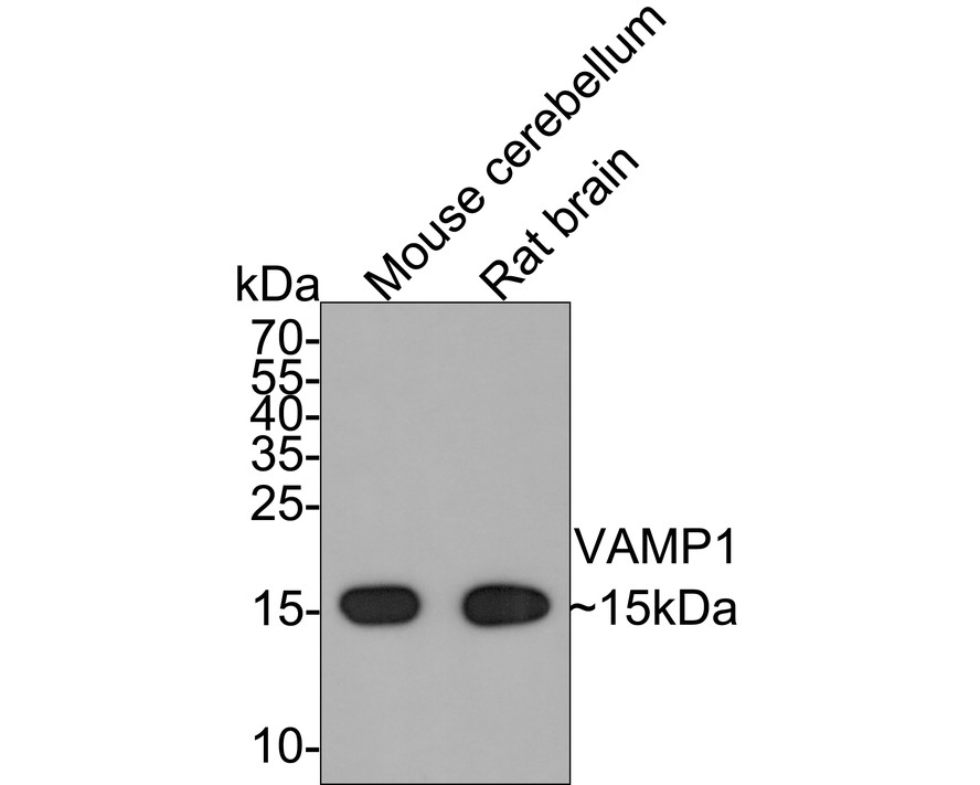 Western blot analysis of VAMP1 on different lysates with Rabbit anti-VAMP1 antibody (ET7109-03) at 1/500 dilution.<br />
<br />
Lane 1: Mouse cerebellum tissue lysate<br />
Lane 2: Rat brain tissue lysate<br />
<br />
Lysates/proteins at 20 µg/Lane.<br />
<br />
Predicted band size: 13 kDa<br />
Observed band size: 15 kDa<br />
<br />
Exposure time: 2 minutes;<br />
<br />
15% SDS-PAGE gel.<br />
<br />
Proteins were transferred to a PVDF membrane and blocked with 5% NFDM/TBST for 1 hour at room temperature. The primary antibody (ET7109-03) at 1/500 dilution was used in 5% NFDM/TBST at room temperature for 2 hours. Goat Anti-Rabbit IgG - HRP Secondary Antibody (HA1001) at 1:300,000 dilution was used for 1 hour at room temperature.