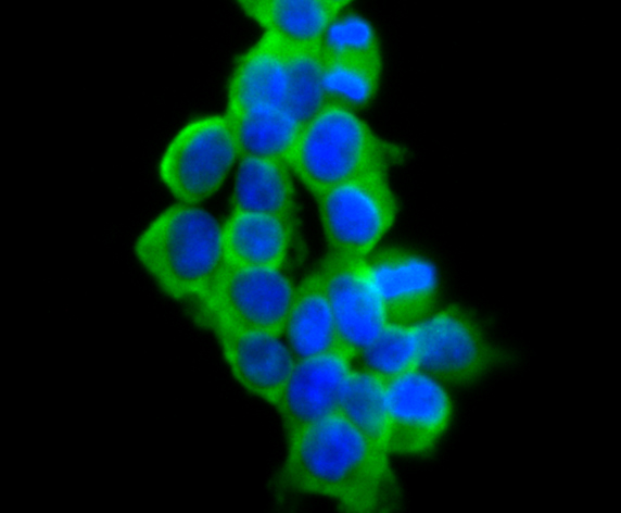 ICC staining VAMP1 in 293T cells (green). The nuclear counter stain is DAPI (blue). Cells were fixed in paraformaldehyde, permeabilised with 0.25% Triton X100/PBS.