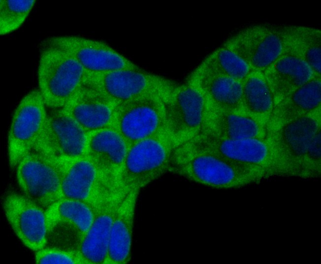 ICC staining VAMP1 in Hela cells (green). The nuclear counter stain is DAPI (blue). Cells were fixed in paraformaldehyde, permeabilised with 0.25% Triton X100/PBS.
