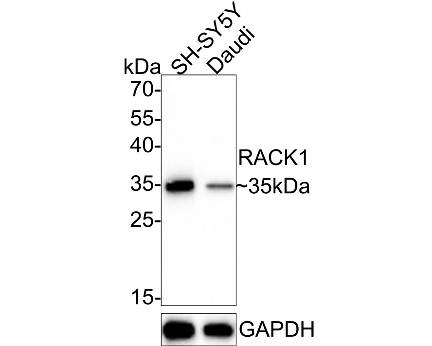 Western blot analysis of RACK1 on different lysates. Proteins were transferred to a PVDF membrane and blocked with 5% BSA in PBS for 1 hour at room temperature. The primary antibody (ET7109-04, 1/500) was used in 5% BSA at room temperature for 2 hours. Goat Anti-Rabbit IgG - HRP Secondary Antibody (HA1001) at 1:200,000 dilution was used for 1 hour at room temperature.<br />
Positive control: <br />
Lane 1: SH-SY-5Y cell lysate<br />
Lane 2: Rat small intestine tissue lysate