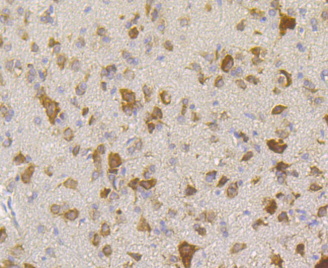 Immunohistochemical analysis of paraffin-embedded rat cerebellum tissue using anti-RACK1 antibody. The section was pre-treated using heat mediated antigen retrieval with Tris-EDTA buffer (pH 9.0) for 20 minutes.The tissues were blocked in 1% BSA for 30 minutes at room temperature, washed with ddH2O and PBS, and then probed with the primary antibody (ET7109-04, 1/50) for 30 minutes at room temperature. The detection was performed using an HRP conjugated compact polymer system. DAB was used as the chromogen. Tissues were counterstained with hematoxylin and mounted with DPX.
