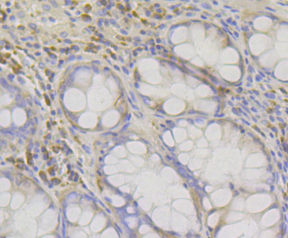Immunohistochemical analysis of paraffin-embedded human colon tissue using anti-RACK1 antibody. The section was pre-treated using heat mediated antigen retrieval with Tris-EDTA buffer (pH 9.0) for 20 minutes.The tissues were blocked in 1% BSA for 30 minutes at room temperature, washed with ddH2O and PBS, and then probed with the primary antibody (ET7109-04, 1/50) for 30 minutes at room temperature. The detection was performed using an HRP conjugated compact polymer system. DAB was used as the chromogen. Tissues were counterstained with hematoxylin and mounted with DPX.