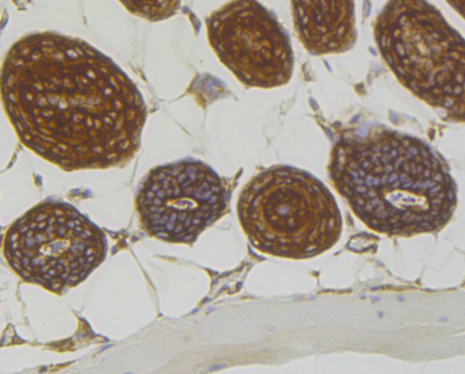 Immunohistochemical analysis of paraffin-embedded mouse skin tissue using anti-RACK1 antibody. The section was pre-treated using heat mediated antigen retrieval with Tris-EDTA buffer (pH 9.0) for 20 minutes.The tissues were blocked in 1% BSA for 30 minutes at room temperature, washed with ddH2O and PBS, and then probed with the primary antibody (ET7109-04, 1/50) for 30 minutes at room temperature. The detection was performed using an HRP conjugated compact polymer system. DAB was used as the chromogen. Tissues were counterstained with hematoxylin and mounted with DPX.