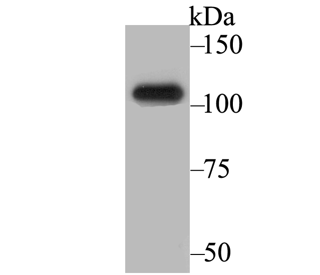 Western blot analysis of BRD2 on SiHa cell lysates. Proteins were transferred to a PVDF membrane and blocked with 5% BSA in PBS for 1 hour at room temperature. The primary antibody (ET7109-07, 1/500) was used in 5% BSA at room temperature for 2 hours. Goat Anti-Rabbit IgG - HRP Secondary Antibody (HA1001) at 1:200,000 dilution was used for 1 hour at room temperature.<br />
<br />
Predicted band size: 88 kDa<br />
Observed band size: 105 kDa