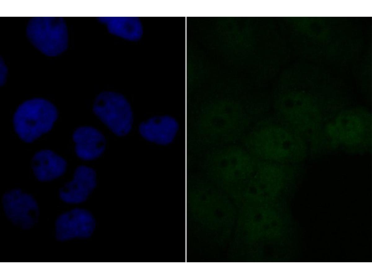 ICC staining of BRD2 in A431 cells (green). Formalin fixed cells were permeabilized with 0.1% Triton X-100 in TBS for 10 minutes at room temperature and blocked with 10% negative goat serum for 15 minutes at room temperature. Cells were probed with the primary antibody (ET7109-07, 1/50) for 1 hour at room temperature, washed with PBS. Alexa Fluor®488 conjugate-Goat anti-Rabbit IgG was used as the secondary antibody at 1/1,000 dilution. The nuclear counter stain is DAPI (blue).