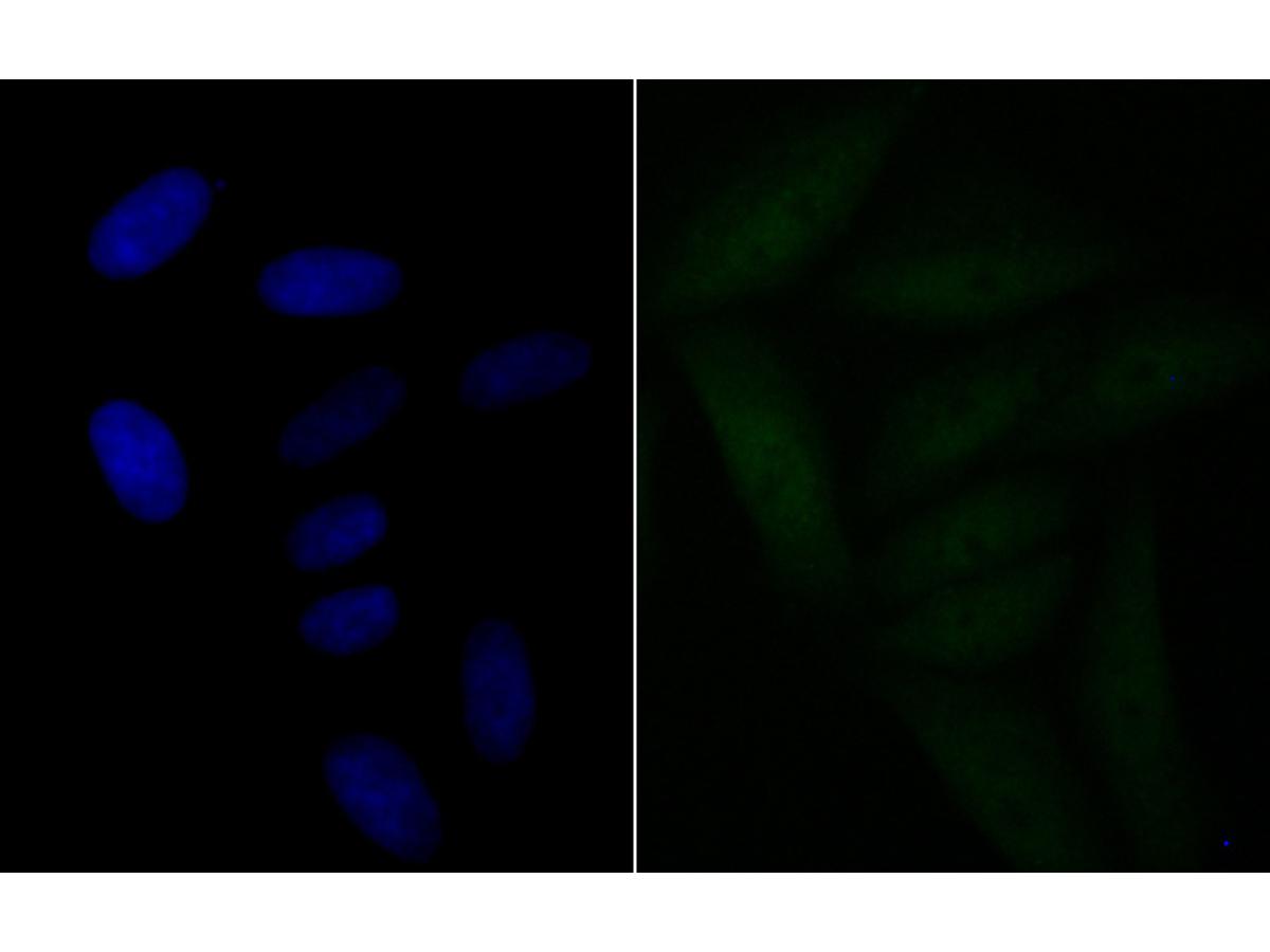ICC staining of BRD2 in SiHa cells (green). Formalin fixed cells were permeabilized with 0.1% Triton X-100 in TBS for 10 minutes at room temperature and blocked with 10% negative goat serum for 15 minutes at room temperature. Cells were probed with the primary antibody (ET7109-07, 1/50) for 1 hour at room temperature, washed with PBS. Alexa Fluor®488 conjugate-Goat anti-Rabbit IgG was used as the secondary antibody at 1/1,000 dilution. The nuclear counter stain is DAPI (blue).
