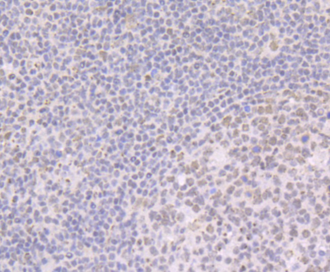 Immunohistochemical analysis of paraffin-embedded human tonsil tissue using anti-BRD2 antibody. The section was pre-treated using heat mediated antigen retrieval with Tris-EDTA buffer (pH 9.0) for 20 minutes.The tissues were blocked in 1% BSA for 30 minutes at room temperature, washed with ddH2O and PBS, and then probed with the primary antibody (ET7109-07, 1/50) for 30 minutes at room temperature. The detection was performed using an HRP conjugated compact polymer system. DAB was used as the chromogen. Tissues were counterstained with hematoxylin and mounted with DPX.