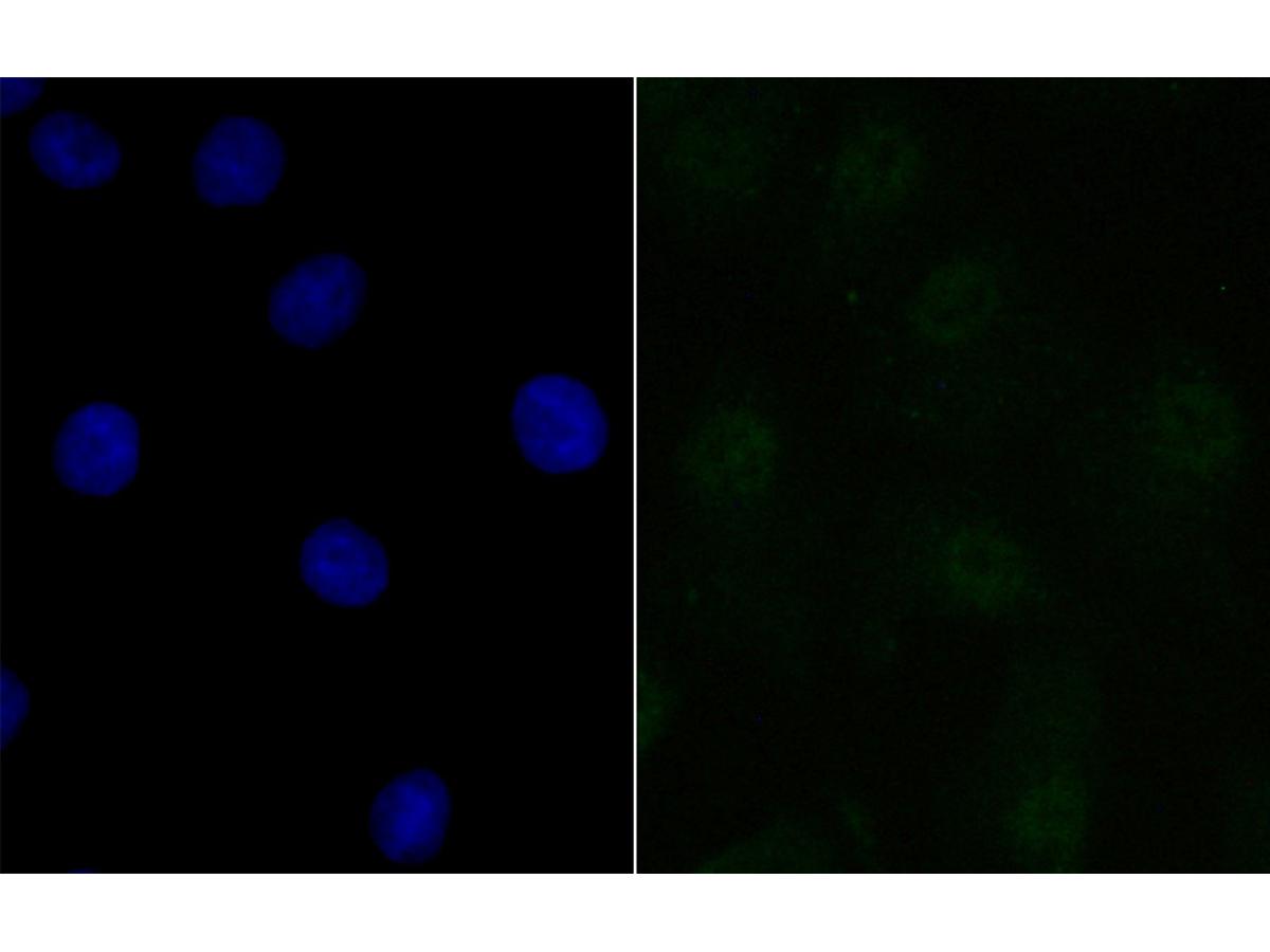 ICC staining of BANF1 in A549 cells (green). Formalin fixed cells were permeabilized with 0.1% Triton X-100 in TBS for 10 minutes at room temperature and blocked with 10% negative goat serum for 15 minutes at room temperature. Cells were probed with the primary antibody (ET7109-08, 1/50) for 1 hour at room temperature, washed with PBS. Alexa Fluor®488 conjugate-Goat anti-Rabbit IgG was used as the secondary antibody at 1/1,000 dilution. The nuclear counter stain is DAPI (blue).