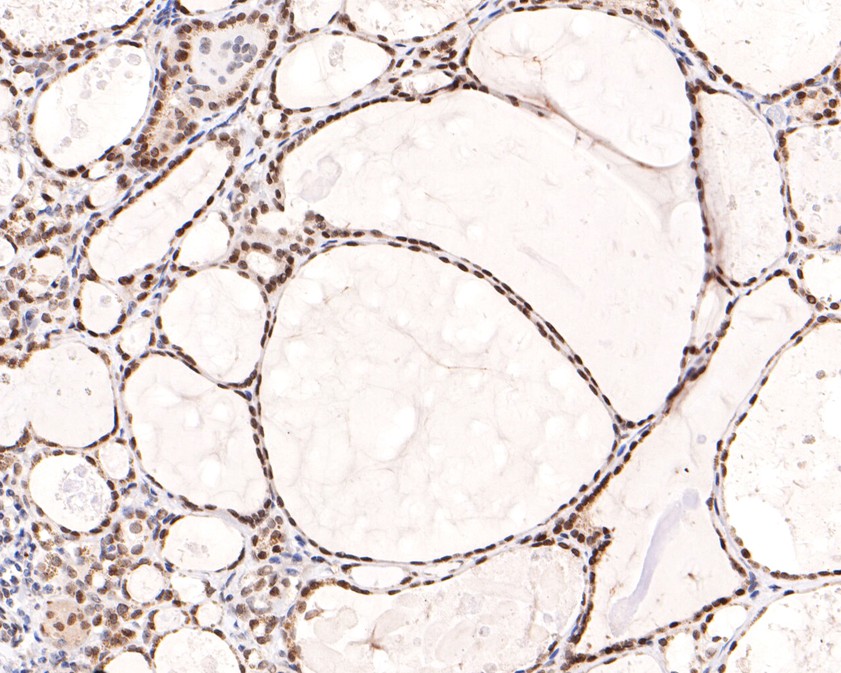 Immunohistochemical analysis of paraffin-embedded human thyroid tissue using anti-BANF1 antibody. The section was pre-treated using heat mediated antigen retrieval with Tris-EDTA buffer (pH 9.0) for 20 minutes.The tissues were blocked in 1% BSA for 30 minutes at room temperature, washed with ddH2O and PBS, and then probed with the primary antibody (ET7109-08, 1/400) for 30 minutes at room temperature. The detection was performed using an HRP conjugated compact polymer system. DAB was used as the chromogen. Tissues were counterstained with hematoxylin and mounted with DPX.