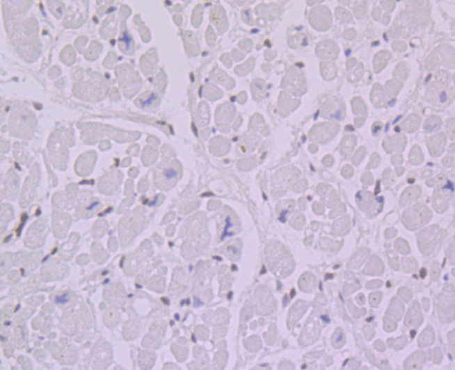 Immunohistochemical analysis of paraffin-embedded human heart tissue using anti-BANF1 antibody. The section was pre-treated using heat mediated antigen retrieval with Tris-EDTA buffer (pH 9.0) for 20 minutes.The tissues were blocked in 1% BSA for 30 minutes at room temperature, washed with ddH2O and PBS, and then probed with the primary antibody (ET7109-08, 1/50) for 30 minutes at room temperature. The detection was performed using an HRP conjugated compact polymer system. DAB was used as the chromogen. Tissues were counterstained with hematoxylin and mounted with DPX.