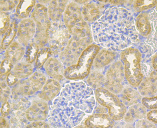 Immunohistochemical analysis of paraffin-embedded rat kidney tissue using anti-Ndufs4 antibody. Counter stained with hematoxylin.