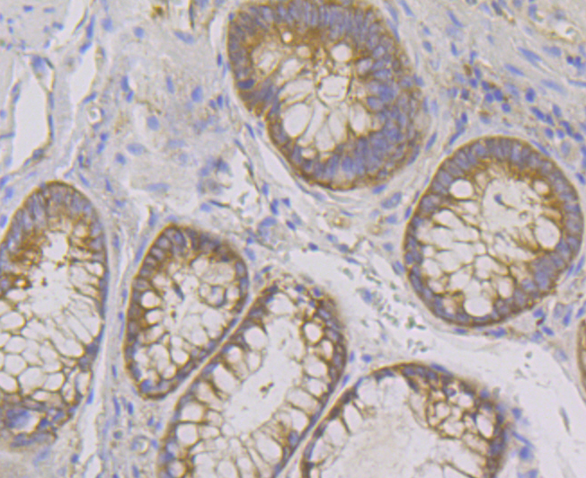 Immunohistochemical analysis of paraffin-embedded human colon tissue using anti-Lysyl tRNA synthetase antibody. Counter stained with hematoxylin.