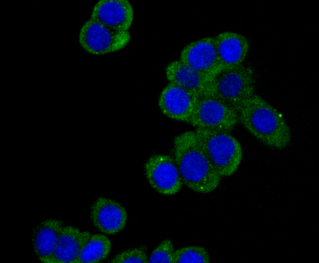 ICC staining DIAPH1 in LOVO cells (green). The nuclear counter stain is DAPI (blue). Cells were fixed in paraformaldehyde, permeabilised with 0.25% Triton X100/PBS.