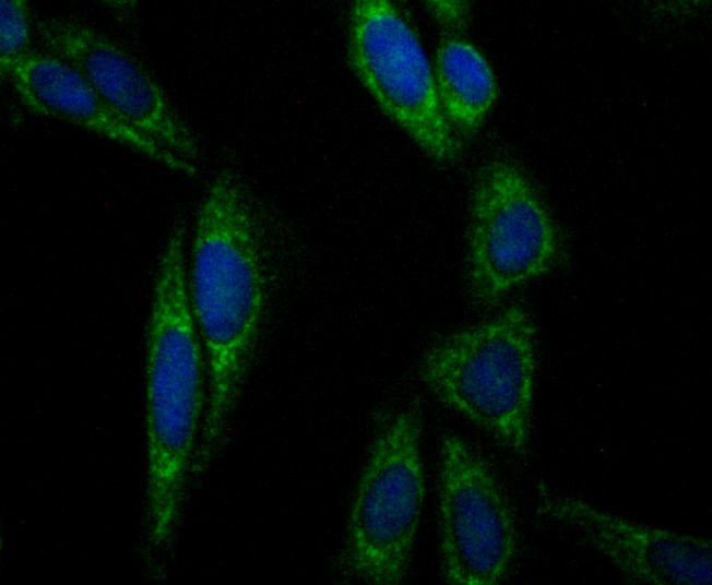 ICC staining Aconitase 2 in SiHa cells (green). The nuclear counter stain is DAPI (blue). Cells were fixed in paraformaldehyde, permeabilised with 0.25% Triton X100/PBS.