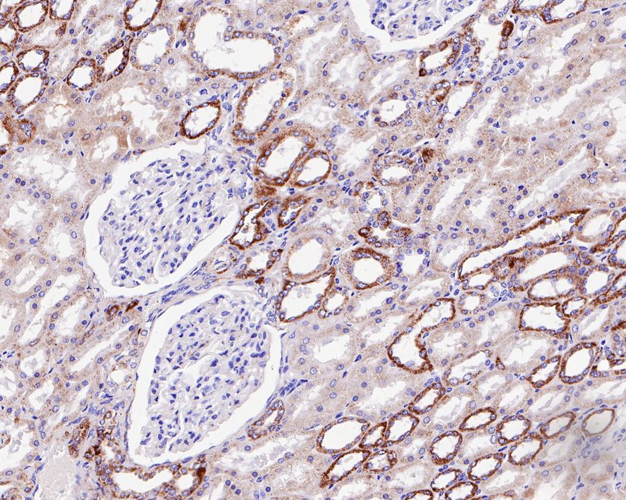 Immunohistochemical analysis of paraffin-embedded human kidney tissue with Rabbit anti-Aconitase 2 antibody (ET7109-15) at 1/1,000 dilution.<br />
<br />
The section was pre-treated using heat mediated antigen retrieval with Tris-EDTA buffer (pH 9.0) for 20 minutes. The tissues were blocked in 1% BSA for 20 minutes at room temperature, washed with ddH2O and PBS, and then probed with the primary antibody (ET7109-15) at 1/1,000 dilution for 1 hour at room temperature. The detection was performed using an HRP conjugated compact polymer system. DAB was used as the chromogen. Tissues were counterstained with hematoxylin and mounted with DPX.