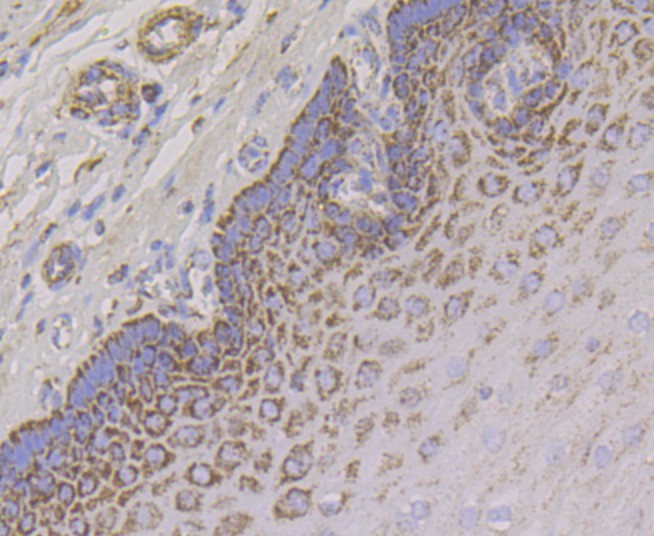 Immunohistochemical analysis of paraffin-embedded human esophagus tissue using anti-Aconitase 2 antibody. Counter stained with hematoxylin.