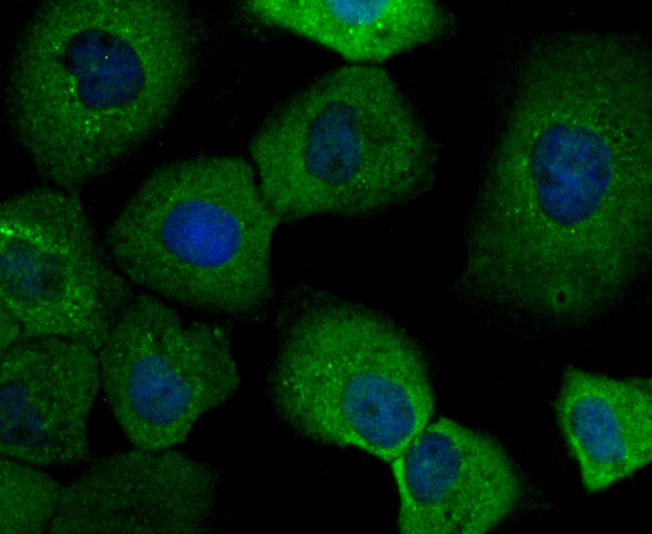ICC staining of IMPDH2 in A431 cells (green). Formalin fixed cells were permeabilized with 0.1% Triton X-100 in TBS for 10 minutes at room temperature and blocked with 10% negative goat serum for 15 minutes at room temperature. Cells were probed with the primary antibody (ET7109-16, 1/50) for 1 hour at room temperature, washed with PBS. Alexa Fluor®488 conjugate-Goat anti-Rabbit IgG was used as the secondary antibody at 1/1,000 dilution. The nuclear counter stain is DAPI (blue).