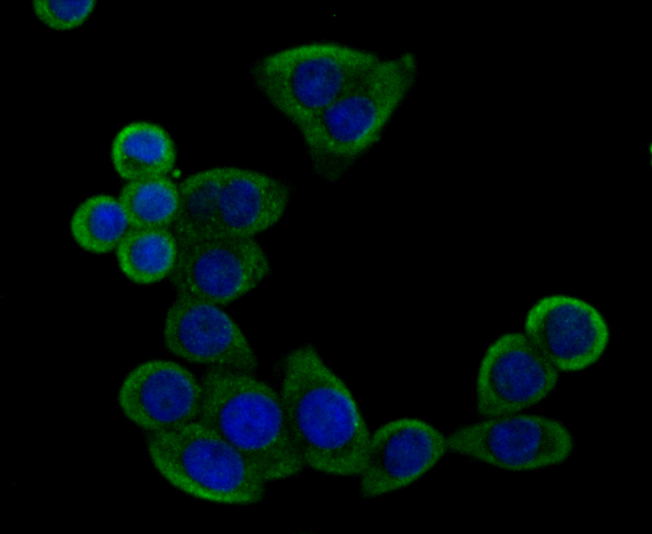 ICC staining of IMPDH2 in LOVO cells (green). Formalin fixed cells were permeabilized with 0.1% Triton X-100 in TBS for 10 minutes at room temperature and blocked with 10% negative goat serum for 15 minutes at room temperature. Cells were probed with the primary antibody (ET7109-16, 1/50) for 1 hour at room temperature, washed with PBS. Alexa Fluor®488 conjugate-Goat anti-Rabbit IgG was used as the secondary antibody at 1/1,000 dilution. The nuclear counter stain is DAPI (blue).