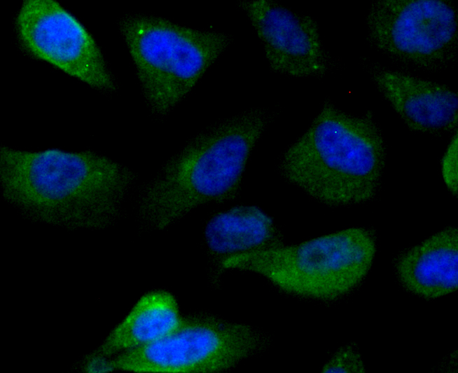 ICC staining of IMPDH2 in PC-3M cells (green). Formalin fixed cells were permeabilized with 0.1% Triton X-100 in TBS for 10 minutes at room temperature and blocked with 10% negative goat serum for 15 minutes at room temperature. Cells were probed with the primary antibody (ET7109-16, 1/50) for 1 hour at room temperature, washed with PBS. Alexa Fluor®488 conjugate-Goat anti-Rabbit IgG was used as the secondary antibody at 1/1,000 dilution. The nuclear counter stain is DAPI (blue).
