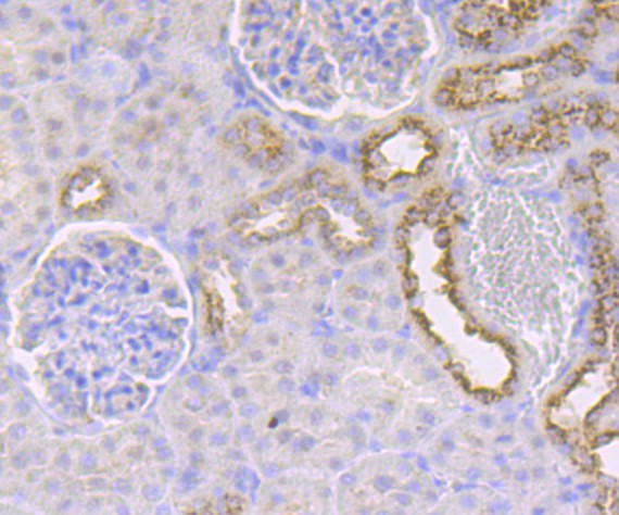 Immunohistochemical analysis of paraffin-embedded rat kidney tissue using anti-IMPDH2 antibody. The section was pre-treated using heat mediated antigen retrieval with Tris-EDTA buffer (pH 9.0) for 20 minutes.The tissues were blocked in 1% BSA for 30 minutes at room temperature, washed with ddH2O and PBS, and then probed with the primary antibody (ET7109-16, 1/50) for 30 minutes at room temperature. The detection was performed using an HRP conjugated compact polymer system. DAB was used as the chromogen. Tissues were counterstained with hematoxylin and mounted with DPX.