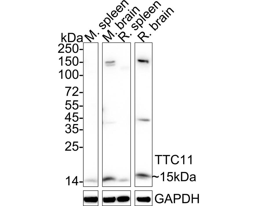 Western blot analysis of TTC11 on SK-Br-3 cell using anti-TTC11 antibody at 1/2,000 dilution.