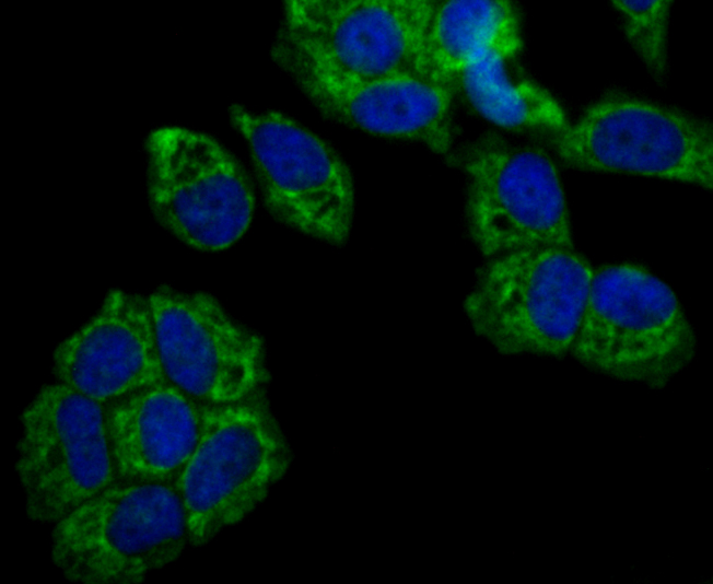 ICC staining TTC11 in SH-SY-5Y cells (green). The nuclear counter stain is DAPI (blue). Cells were fixed in paraformaldehyde, permeabilised with 0.25% Triton X100/PBS.