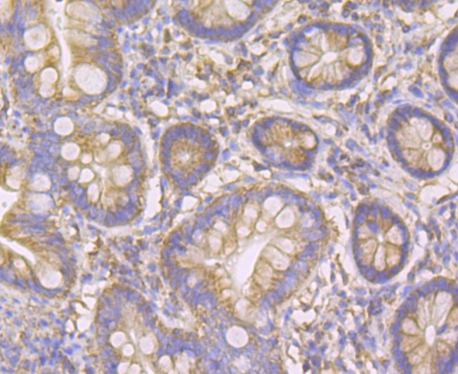Immunohistochemical analysis of paraffin-embedded human uterus tissue using anti-TTC11 antibody. Counter stained with hematoxylin.