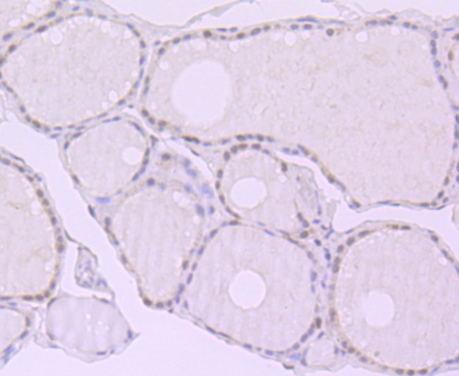 Immunohistochemical analysis of paraffin-embedded human thyroid gland tissue using anti-Exportin-5 antibody. Counter stained with hematoxylin.