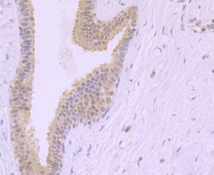 Immunohistochemical analysis of paraffin-embedded human breast tissue using anti-Exportin-5 antibody. Counter stained with hematoxylin.