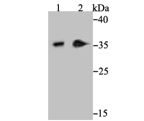 Western blot analysis of Syntaxin 3 on SH-SY-5Y cell (1) and human kidney tissue (2) lysate using anti-Syntaxin 3 antibody at 1/1,000 dilution.