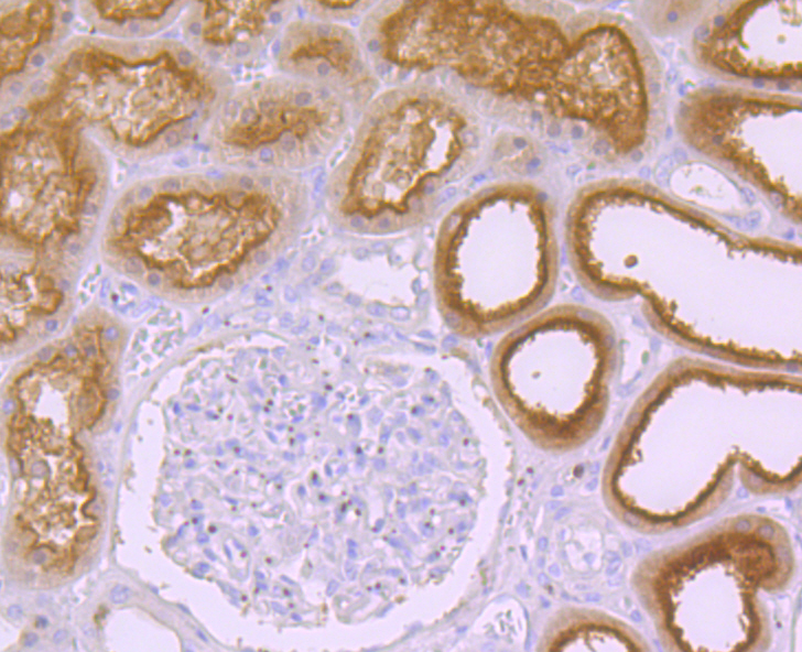 Immunohistochemical analysis of paraffin-embedded human kidney tissue using anti-Syntaxin 3 antibody. Counter stained with hematoxylin.