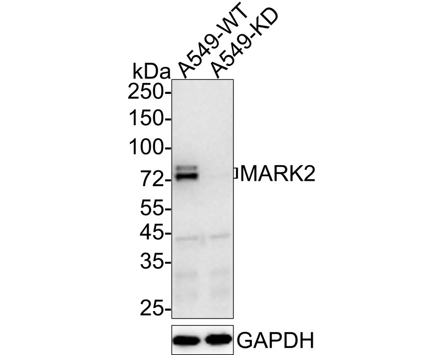 Western blot analysis of MARK2 on MCF-7 (1) and SK-Br-3 (2) cell lysate using anti-MARK2 antibody at 1/2,000 dilution.