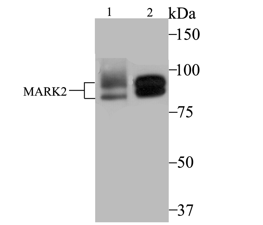 Immunohistochemical analysis of paraffin-embedded human appendix tissue using anti-MARK2 antibody. Counter stained with hematoxylin.