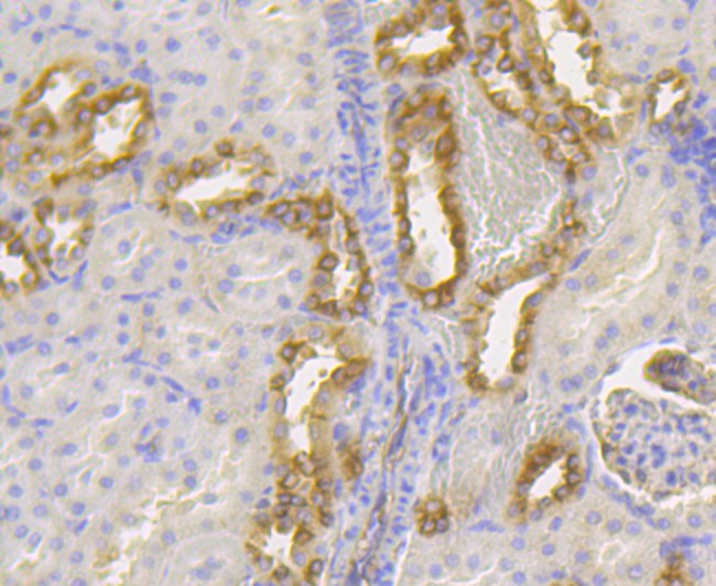 Immunohistochemical analysis of paraffin-embedded rat kidney tissue using anti-Lumican antibody. The section was pre-treated using heat mediated antigen retrieval with Tris-EDTA buffer (pH 9.0) for 20 minutes.The tissues were blocked in 1% BSA for 30 minutes at room temperature, washed with ddH2O and PBS, and then probed with the primary antibody (ET7109-24, 1/50) for 30 minutes at room temperature. The detection was performed using an HRP conjugated compact polymer system. DAB was used as the chromogen. Tissues were counterstained with hematoxylin and mounted with DPX.