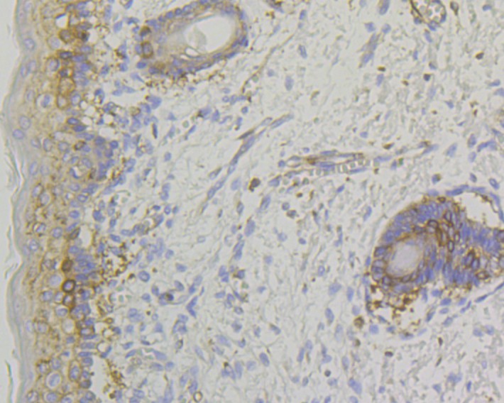 Immunohistochemical analysis of paraffin-embedded human skin tissue using anti-Lumican antibody. The section was pre-treated using heat mediated antigen retrieval with Tris-EDTA buffer (pH 9.0) for 20 minutes.The tissues were blocked in 1% BSA for 30 minutes at room temperature, washed with ddH2O and PBS, and then probed with the primary antibody (ET7109-24, 1/50) for 30 minutes at room temperature. The detection was performed using an HRP conjugated compact polymer system. DAB was used as the chromogen. Tissues were counterstained with hematoxylin and mounted with DPX.