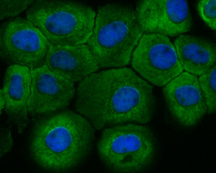ICC staining of Fbx32 in A431 cells (green). Formalin fixed cells were permeabilized with 0.1% Triton X-100 in TBS for 10 minutes at room temperature and blocked with 10% negative goat serum for 15 minutes at room temperature. Cells were probed with the primary antibody (ET7109-25, 1/50) for 1 hour at room temperature, washed with PBS. Alexa Fluor®488 conjugate-Goat anti-Rabbit IgG was used as the secondary antibody at 1/1,000 dilution. The nuclear counter stain is DAPI (blue).