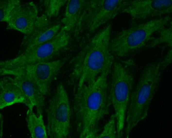 ICC staining of Fbx32 in L6 cells (green). Formalin fixed cells were permeabilized with 0.1% Triton X-100 in TBS for 10 minutes at room temperature and blocked with 10% negative goat serum for 15 minutes at room temperature. Cells were probed with the primary antibody (ET7109-25, 1/50) for 1 hour at room temperature, washed with PBS. Alexa Fluor®488 conjugate-Goat anti-Rabbit IgG was used as the secondary antibody at 1/1,000 dilution. The nuclear counter stain is DAPI (blue).