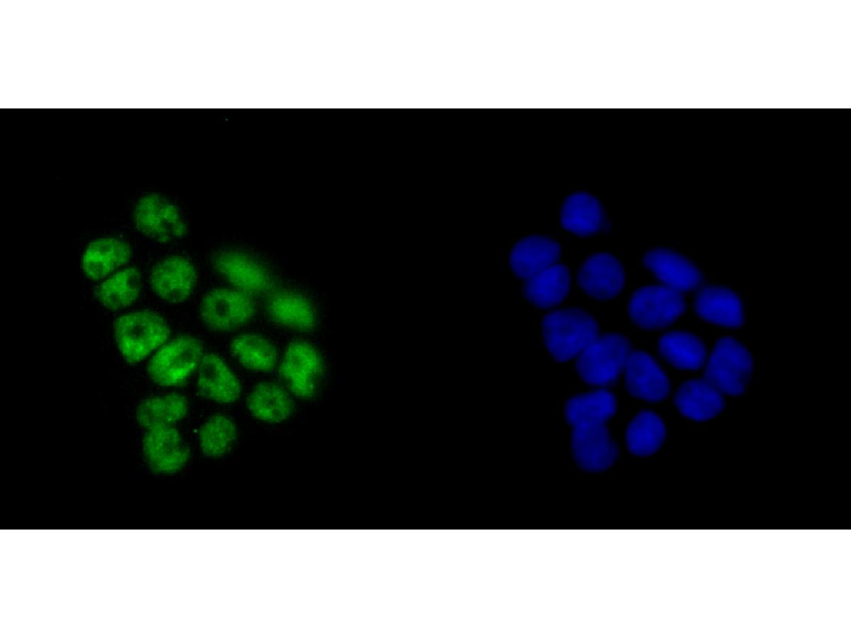 ICC staining of KHSRP in 293T cells (green). Formalin fixed cells were permeabilized with 0.1% Triton X-100 in TBS for 10 minutes at room temperature and blocked with 10% negative goat serum for 15 minutes at room temperature. Cells were probed with the primary antibody (ET7109-30, 1/50) for 1 hour at room temperature, washed with PBS. Alexa Fluor®488 conjugate-Goat anti-Rabbit IgG was used as the secondary antibody at 1/1,000 dilution. The nuclear counter stain is DAPI (blue).