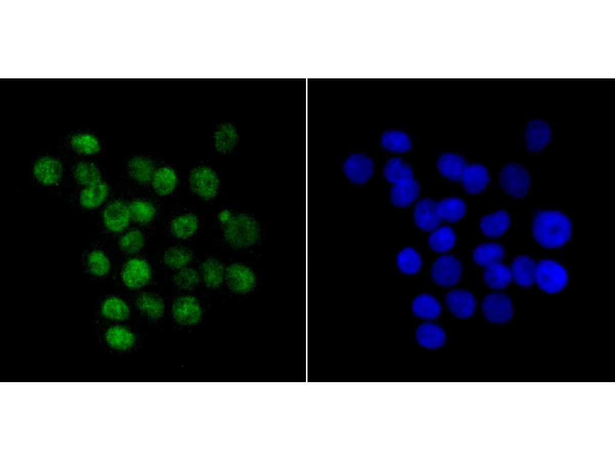 ICC staining of KHSRP in LOVO cells (green). Formalin fixed cells were permeabilized with 0.1% Triton X-100 in TBS for 10 minutes at room temperature and blocked with 10% negative goat serum for 15 minutes at room temperature. Cells were probed with the primary antibody (ET7109-30, 1/50) for 1 hour at room temperature, washed with PBS. Alexa Fluor®488 conjugate-Goat anti-Rabbit IgG was used as the secondary antibody at 1/1,000 dilution. The nuclear counter stain is DAPI (blue).