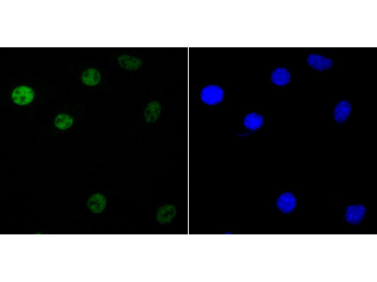 ICC staining of KHSRP in SH-SY5Y cells (green). Formalin fixed cells were permeabilized with 0.1% Triton X-100 in TBS for 10 minutes at room temperature and blocked with 10% negative goat serum for 15 minutes at room temperature. Cells were probed with the primary antibody (ET7109-30, 1/50) for 1 hour at room temperature, washed with PBS. Alexa Fluor®488 conjugate-Goat anti-Rabbit IgG was used as the secondary antibody at 1/1,000 dilution. The nuclear counter stain is DAPI (blue).