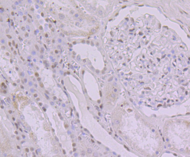 Immunohistochemical analysis of paraffin-embedded human kidney tissue using anti-KHSRP antibody. The section was pre-treated using heat mediated antigen retrieval with Tris-EDTA buffer (pH 9.0) for 20 minutes.The tissues were blocked in 1% BSA for 30 minutes at room temperature, washed with ddH2O and PBS, and then probed with the primary antibody (ET7109-30, 1/50) for 30 minutes at room temperature. The detection was performed using an HRP conjugated compact polymer system. DAB was used as the chromogen. Tissues were counterstained with hematoxylin and mounted with DPX.