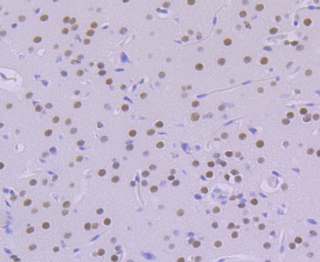 Immunohistochemical analysis of paraffin-embedded mouse brain tissue using anti-KHSRP antibody. The section was pre-treated using heat mediated antigen retrieval with Tris-EDTA buffer (pH 9.0) for 20 minutes.The tissues were blocked in 1% BSA for 30 minutes at room temperature, washed with ddH2O and PBS, and then probed with the primary antibody (ET7109-30, 1/50) for 30 minutes at room temperature. The detection was performed using an HRP conjugated compact polymer system. DAB was used as the chromogen. Tissues were counterstained with hematoxylin and mounted with DPX.
