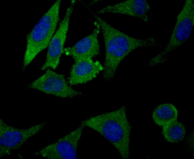 ICC staining CLASP1 in SH-SY-5Y cells (green). Formalin fixed cells were permeabilized with 0.1% Triton X-100 in TBS for 10 minutes at room temperature and blocked with 1% Blocker BSA for 15 minutes at room temperature. Cells were probed with YTHDF1 polyclonal antibody at a dilution of 1:50 for 1 hour at room temperature, washed with PBS. Alexa Fluorc™ 488 Goat anti-Rabbit IgG was used as the secondary antibody at 1/100 dilution. The nuclear counter stain is DAPI (blue).