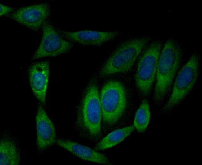 ICC staining CLASP1 in SiHa cells (green). Formalin fixed cells were permeabilized with 0.1% Triton X-100 in TBS for 10 minutes at room temperature and blocked with 1% Blocker BSA for 15 minutes at room temperature. Cells were probed with YTHDF1 polyclonal antibody at a dilution of 1:50 for 1 hour at room temperature, washed with PBS. Alexa Fluorc™ 488 Goat anti-Rabbit IgG was used as the secondary antibody at 1/100 dilution. The nuclear counter stain is DAPI (blue).