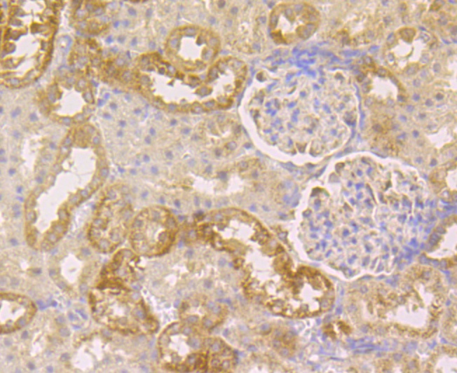 Immunohistochemical analysis of paraffin-embedded rat kidney tissue using anti-CLASP1 antibody. The section was pre-treated using heat mediated antigen retrieval with Tris-EDTA buffer (pH 8.0-8.4) for 20 minutes.The tissues were blocked in 5% BSA for 30 minutes at room temperature, washed with ddH2O and PBS, and then probed with the antibody (ET7109-31) at 1/50 dilution, for 30 minutes at room temperature and detected using an HRP conjugated compact polymer system. DAB was used as the chrogen. Counter stained with hematoxylin and mounted with DPX.